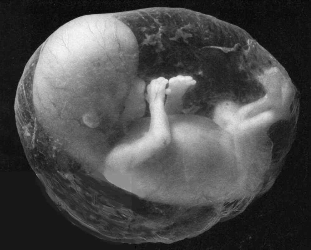 {Human fetus art ~ Via Tumblr ~ Original Source: Unknown}