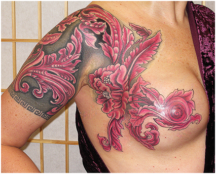 Making the Breast Decision: Mastectomy & Reconstruction ...